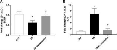 Brimonidine is Neuroprotective in Animal Paradigm of Retinal Ganglion Cell Damage